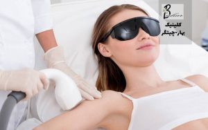 لیزر موهای زائد بهتر است یا اپیلاسیون؟