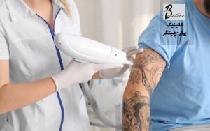 بهترین مرکز لیزر تاتو در غرب تهران
