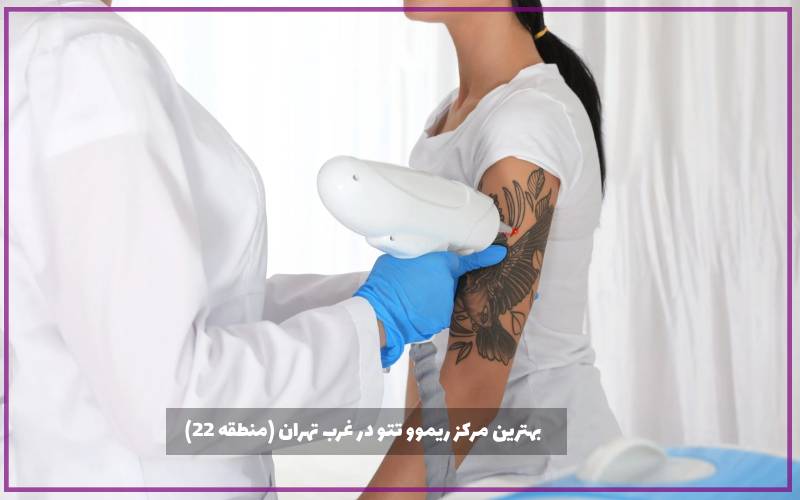 بهترین مرکز ریموو تتو در غرب تهران (منطقه 22)