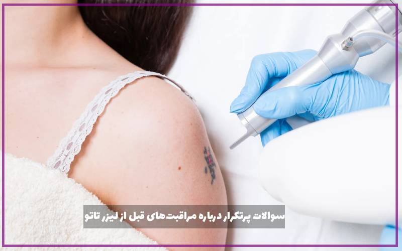 سوالات پرتکرار درباره مراقبت‌های قبل از لیزر تاتو