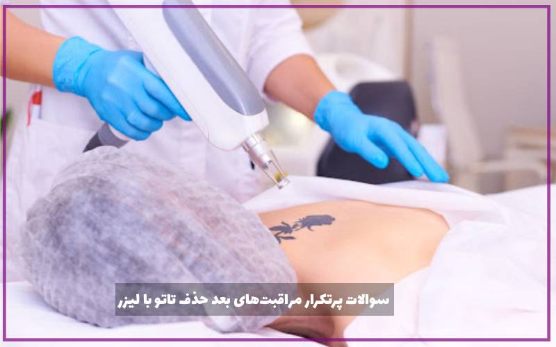 سوالات پرتکرار درباره مراقبت‌های بعد از پاک کردن تاتو با لیزر