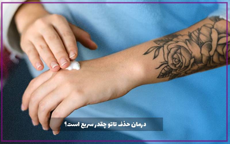 درمان حذف تاتو چقدر سریع است؟