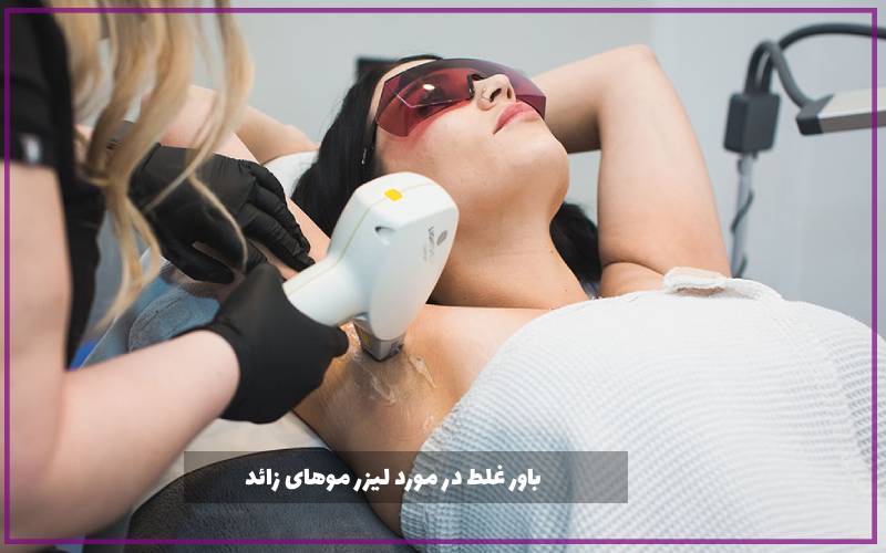 باور غلط در مورد لیزر موهای زائد