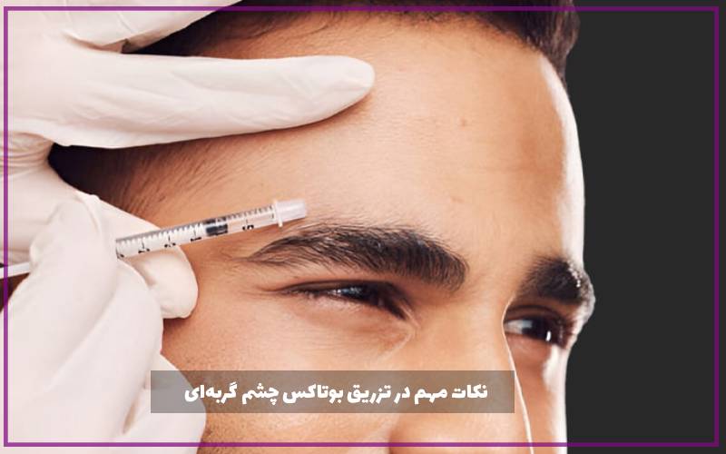 نکات مهم در تزریق بوتاکس چشم گربه‌ای